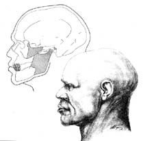 Реконструкция профиля по черепу. Этапы работы